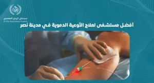 كيف تختار أفضل مستشفى لعلاج الأوعية الدموية في مدينة نصر؟