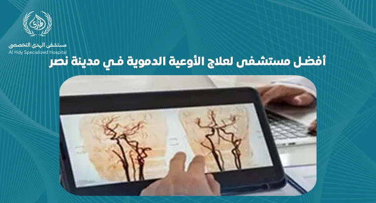 كيف تختار أفضل مستشفى لعلاج الأوعية الدموية في مدينة نصر؟