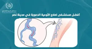 كيف تختار أفضل مستشفى لعلاج الأوعية الدموية في مدينة نصر؟