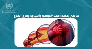  ما هي جلطة القلب؟ تعرف على الأعراض والأسباب وطرق العلاج الفعالة