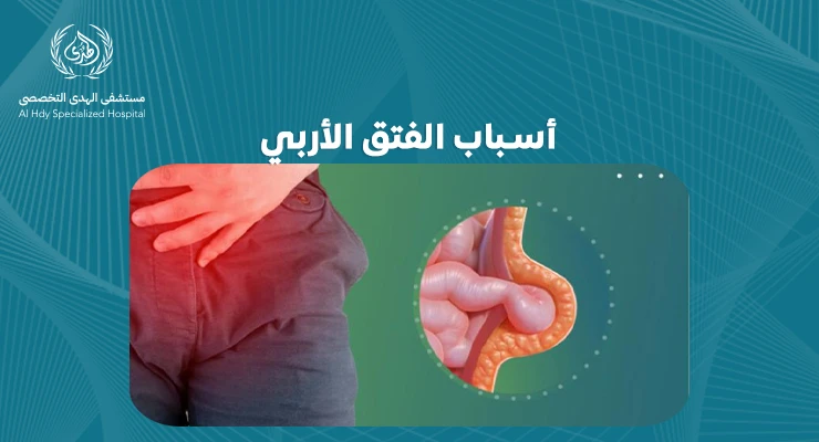 أسباب الفتق الأربي: دليل شامل لفهم الحالة وعلاجها
