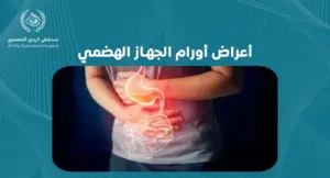 كيف تكتشف أعراض أورام الجهاز الهضمي: علامات يجب الانتباه لها
