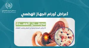 كيف تكتشف أعراض أورام الجهاز الهضمي: علامات يجب الانتباه لها