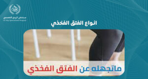 انواع الفتق الفخذي: دليل شامل لفهم الأنواع والأعراض والعلاج