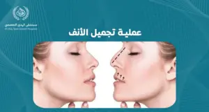 عملية تجميل الأنف: دليل شامل لتحقيق المظهر المثالي - الهدي