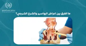 ما الفرق بين اعراض البواسير والشرخ الشرجي؟