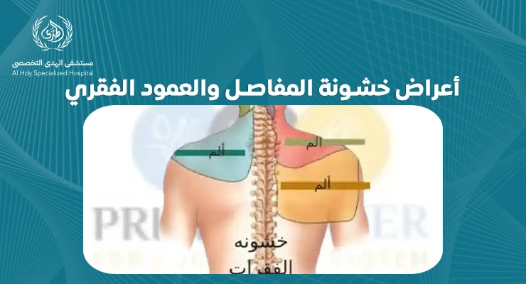 تعرف على أعراض خشونة المفاصل والعمود الفقري وأفضل طرق العلاج