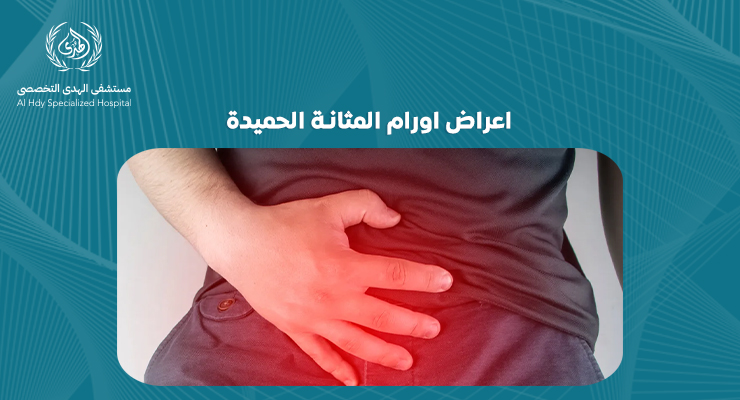 اعراض اورام المثانة الحميدة: كيف تكتشفها مبكرًا وتتعامل معها