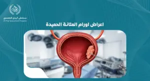 اعراض اورام المثانة الحميدة: كيف تكتشفها مبكرًا وتتعامل معها