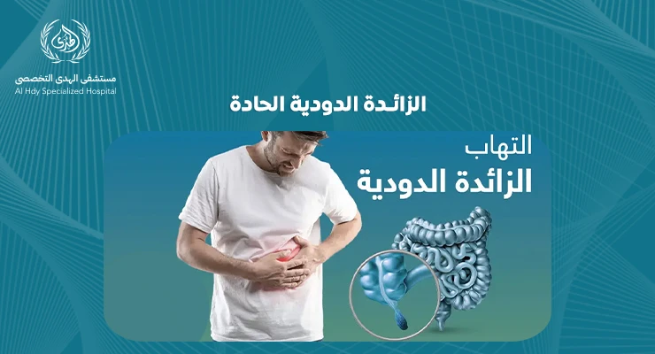 كل ما تحتاج معرفته عن الزائدة الدودية الحادة: الأعراض والتشخيص والعلاج