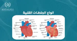 انواع الجلطات القلبية: فهم الأنواع المختلفة وأسبابها - الهدي