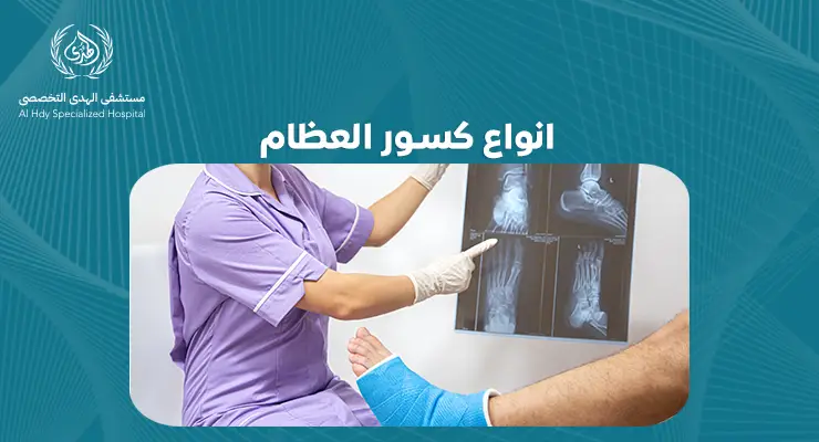 انواع كسور العظام