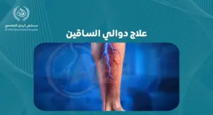  خطوات بسيطة لعلاج دوالي الساقين: نصائح وإرشادات للوقاية