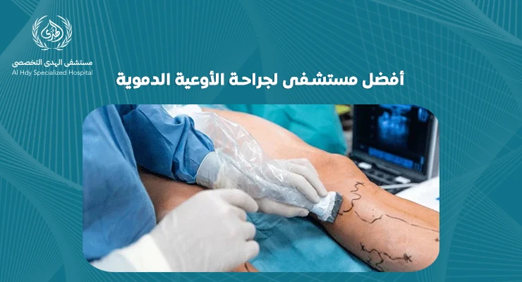 أفضل مستشفى لجراحة الأوعية الدموية