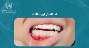 استئصال اورام الفك: خطوات العلاج والتعافي - مستشفي الهدي