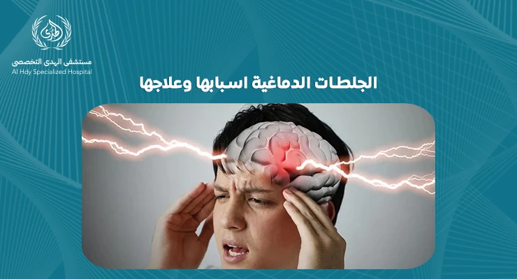 الجلطات الدماغية اسبابها وعلاجها