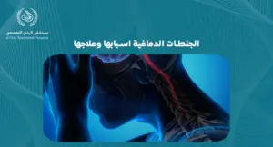 الجلطات الدماغية اسبابها وعلاجها