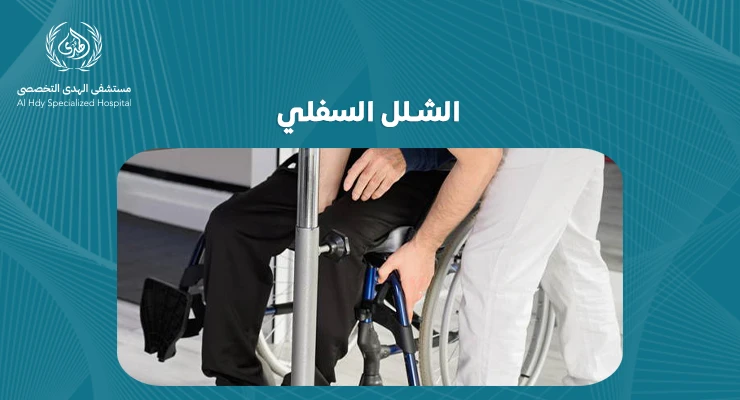 الشلل السفلي