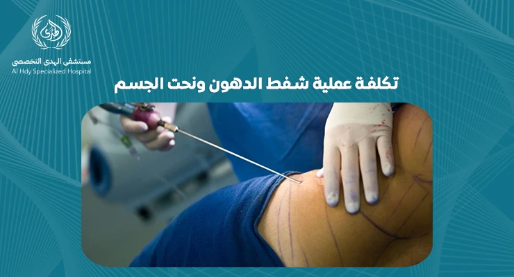 تكلفة عملية شفط الدهون ونحت الجسم