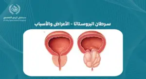 سرطان البروستاتا الأعراض والأسباب: التي يجب أن تعرفها- الهدي