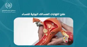 أفضل طرق علاج التهابات المسالك البولية للنساء: دليل شامل