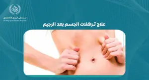 علاج ترهلات الجسم بعد الرجيم