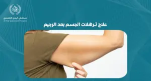 علاج ترهلات الجسم بعد الرجيم