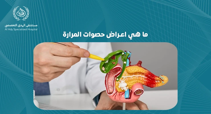 ما هي اعراض حصوات المرارة