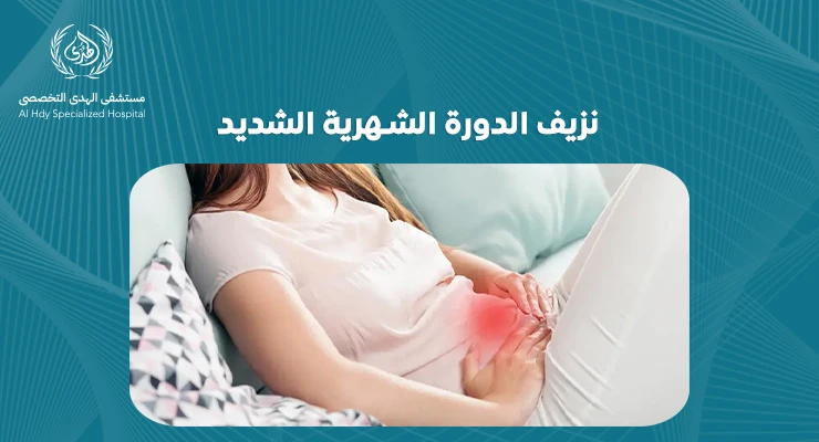 نزيف الدورة الشهرية الشديد