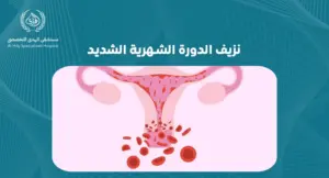 نزيف الدورة الشهرية الشديد