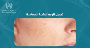 تجميل الوجه للبشرة الحساسة