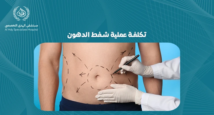 تكلفة عملية شفط الدهون