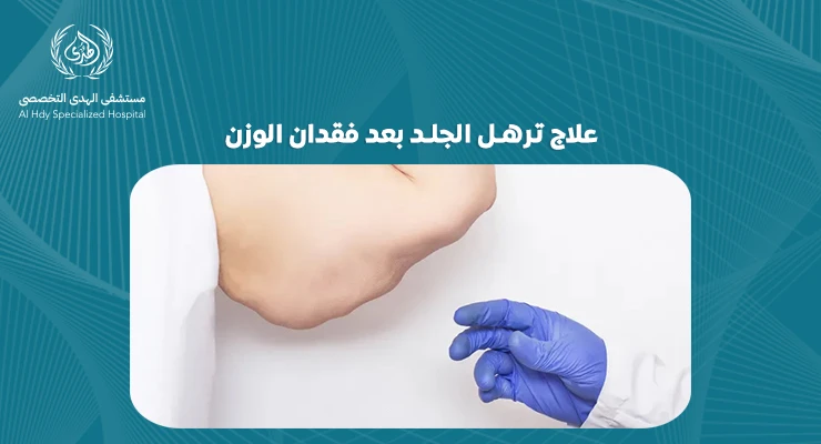 علاج ترهل الجلد بعد فقدان الوزن