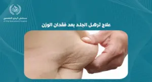 علاج ترهل الجلد بعد فقدان الوزن