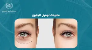 عمليات تجميل الجفون