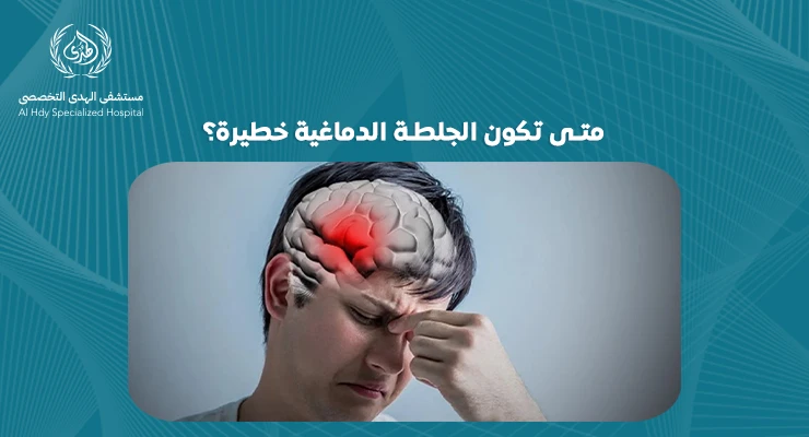متى تكون الجلطة الدماغية خطيرة؟