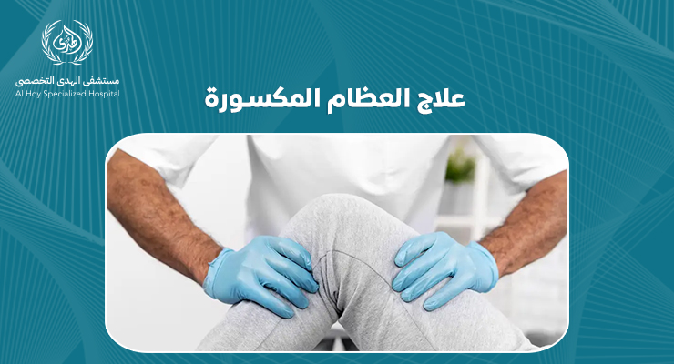 علاج العظام المكسورة