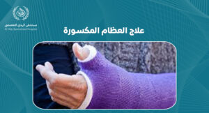 علاج العظام المكسورة