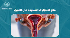 علاج الالتهابات الشديده في المهبل